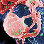 Elektronmikroskopický obrázek viru HIV